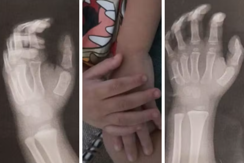 Uma professora da rede municipal de Guarujá, no litoral de São Paulo, foi flagrada agredindo um aluno de apenas três anos dent